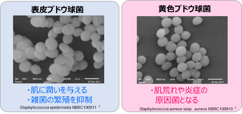 球菌 ブドウ コアグラーゼ 陰性