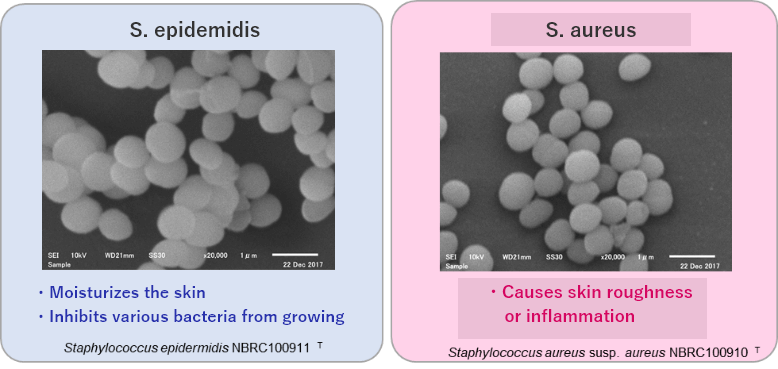 Staphylococcus epidermidis and Staphylococcus aureus