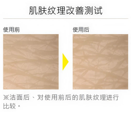 肌肤纹理改善测试