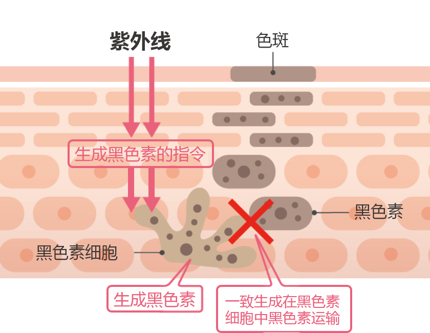 美白