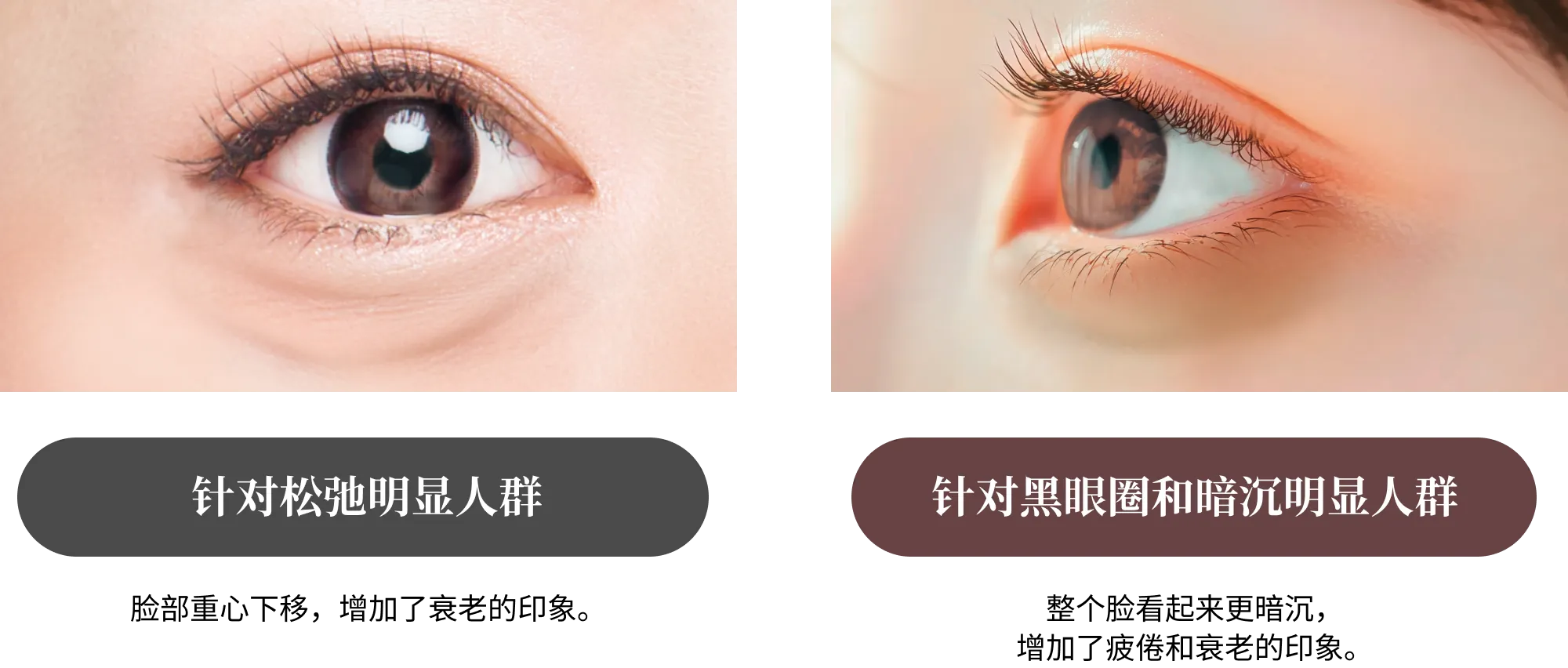 针对松弛明显人群・针对黑眼圈和暗沉明显人群