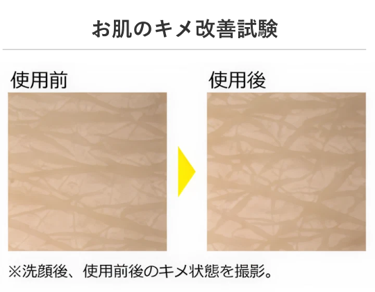 お肌のキメ改善試験