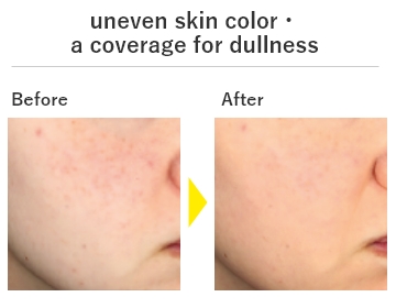 uneven skin color・a coverage for dullness