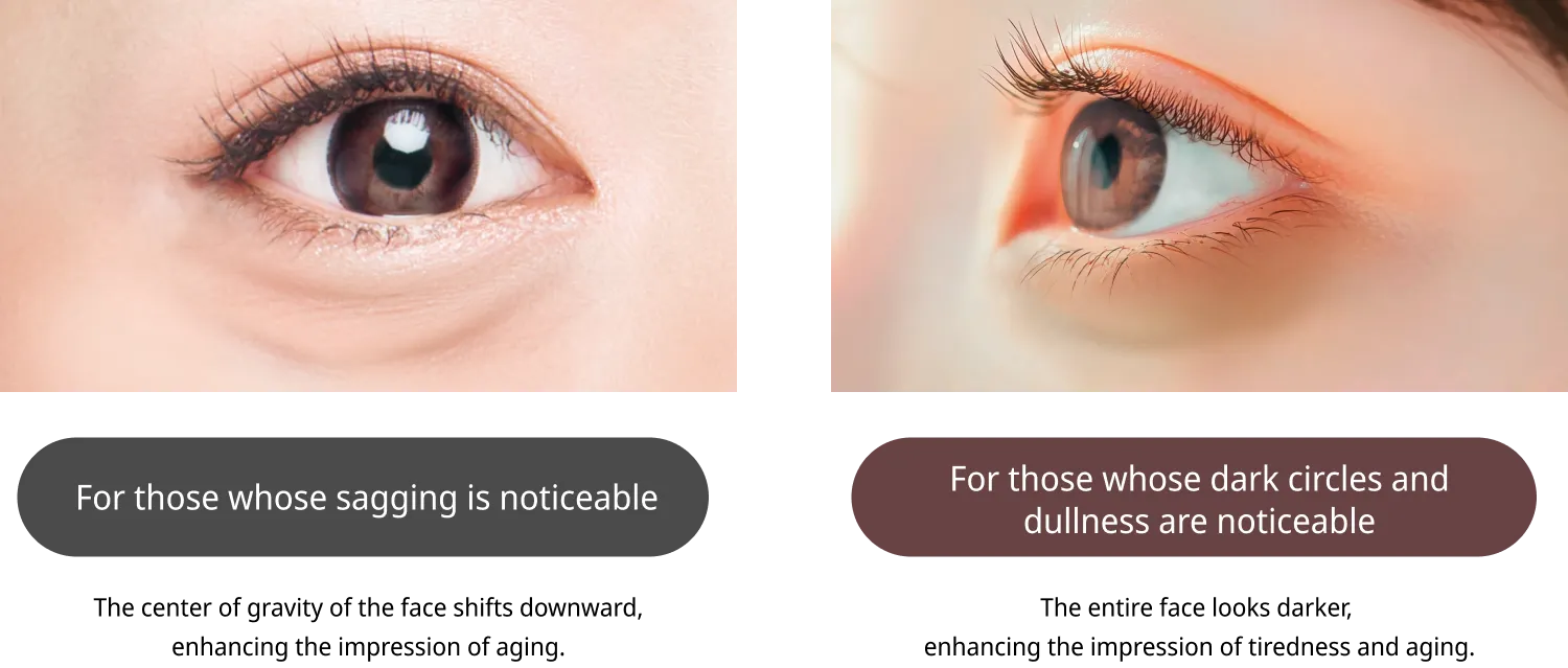 For those whose sagging is noticeable For those whose dark circles and dullness are noticeable