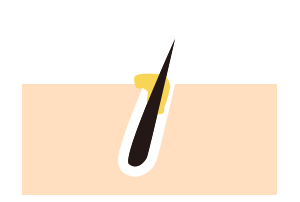 Remove excess sebum and dirt which clogged in pores